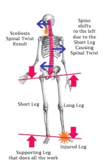 skeleton posture copy