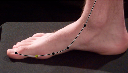 The Path of the Spleen Meridian through the Arch of the Foot