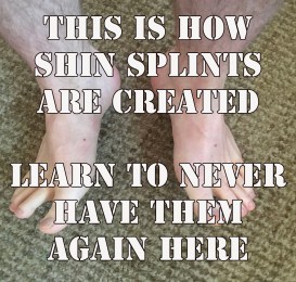 Shine splints never again